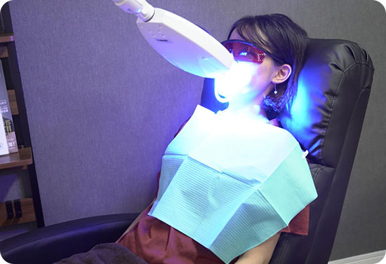 セルフホワイトニング